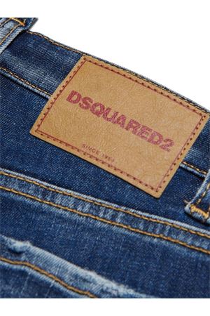 Blue Cotton Shorts DSQUARED KIDS | DQ0787D0A6LDQ01